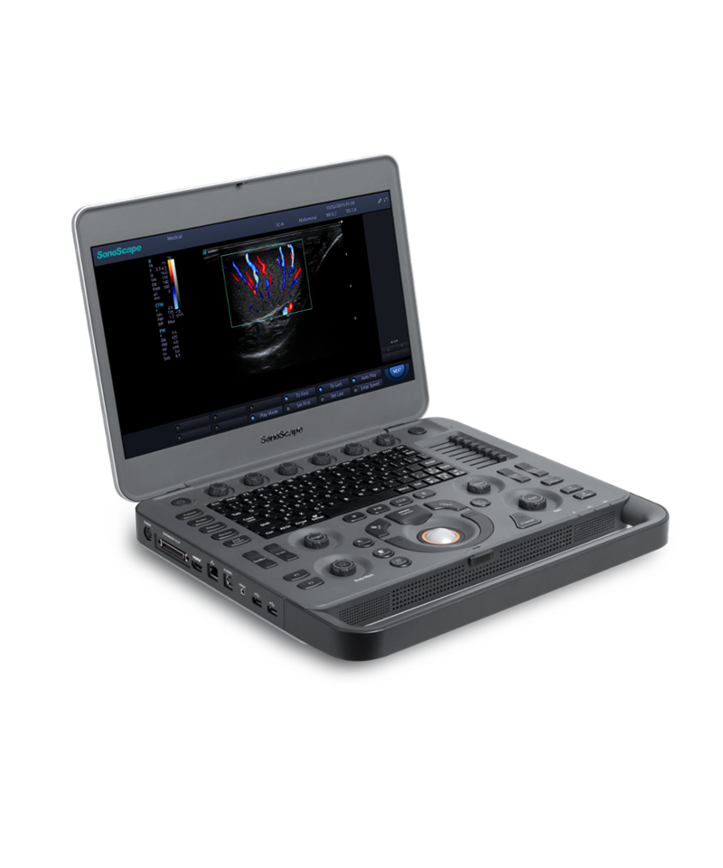 Sonoscope X3 Color Doppler Ultrasound